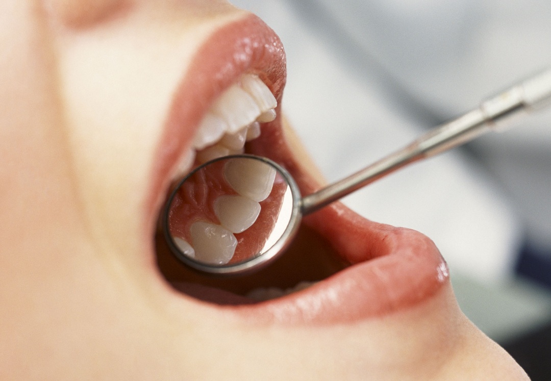 лечения зубов