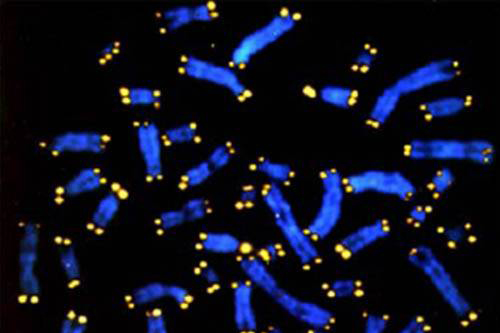 Stained human chromosomes (blue) and their telomeres (yellow).