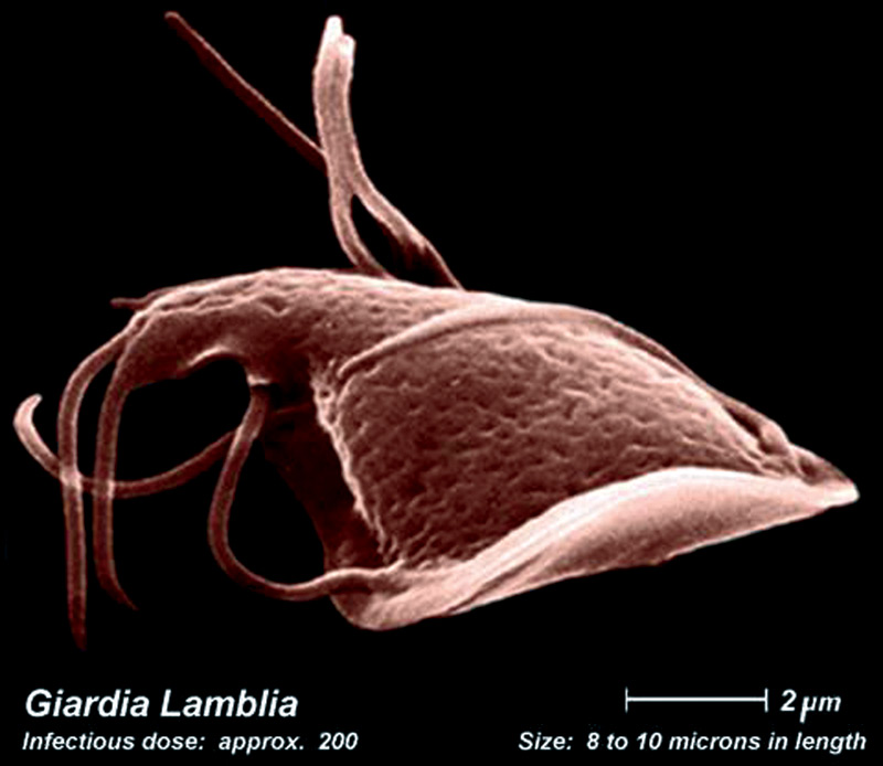 Parasites, giardia, helmints, lamblia