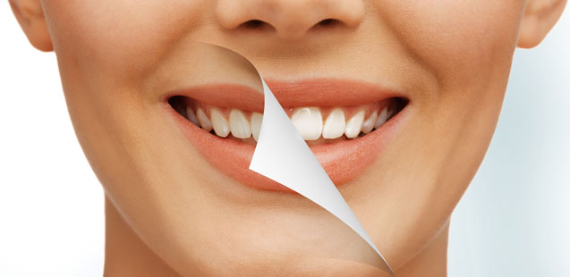 отбеливание зубов